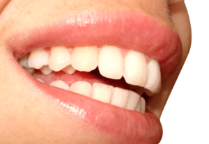 oral-probiotics-for-bad-breath