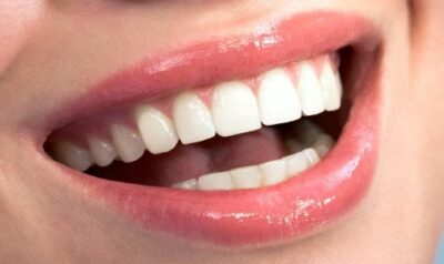 Clean healthy smiling teeth